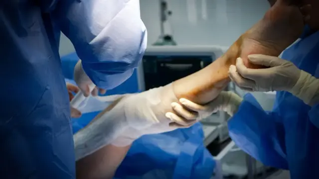 Surgical team in blue gowns and gloves working on a patient's raised lower leg beside an ultrasound monitor in an operating room